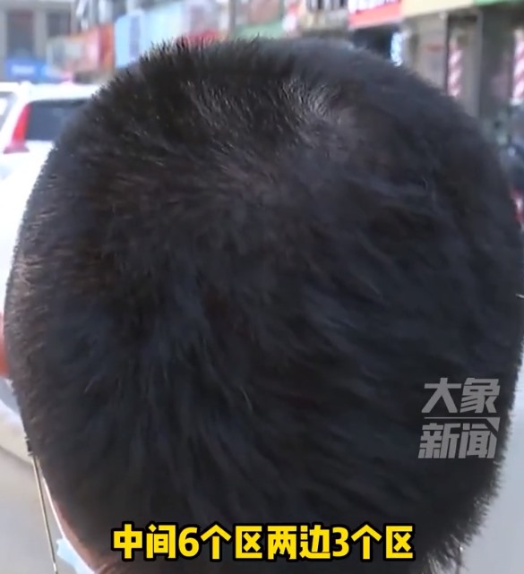 杭州一男子去烫头，理发店按照头皮分区收费，分12个区每区398元