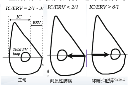 加强肺功能培训，提高肺功能解读能力