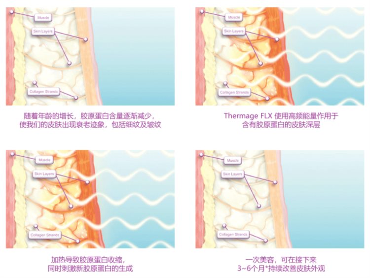 深调查｜热玛吉假货泛滥？专家：处于灰色地带，监管存在难点