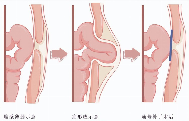 计算机老师转行做出一个IPO，“十男九疝”的生意好做吗？