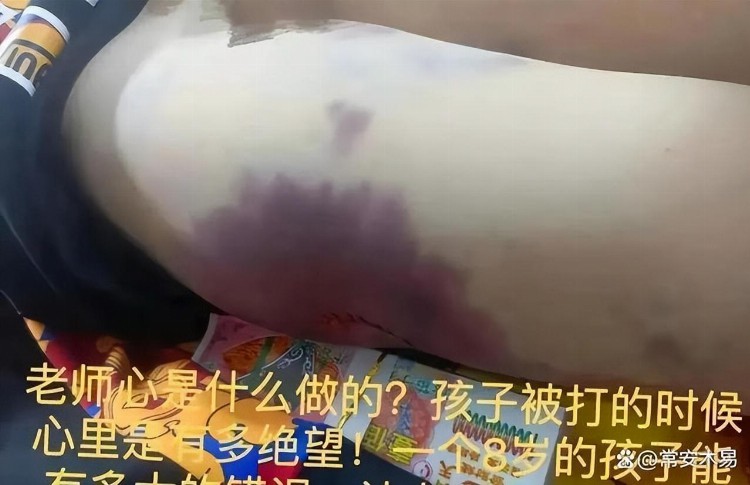 网传八岁男童武术教练殴打致死的视频引发的思考