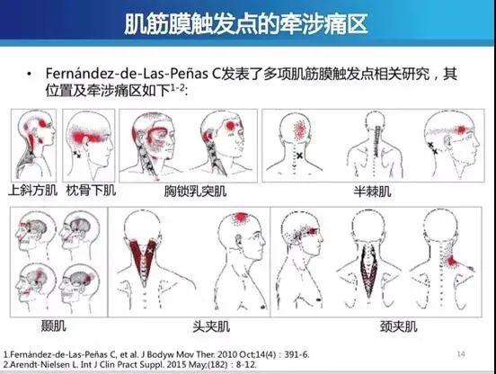 “我想拧掉脑袋！”杭州15岁学霸一刷题就头痛欲裂！医生：这个习惯太差了，家长一定要看