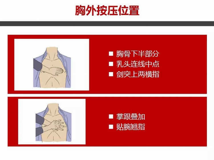 成人心肺复苏操作流程培训PPT课件（非常详细）