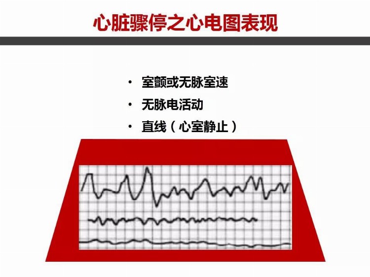 成人心肺复苏操作流程培训PPT课件（非常详细）